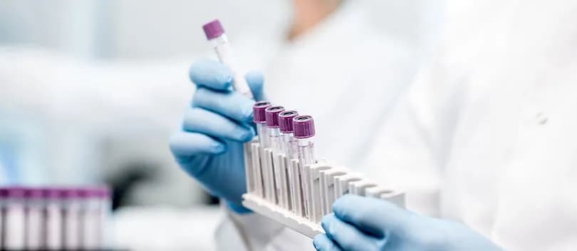 Laboratory scientist handling blood sample tubes